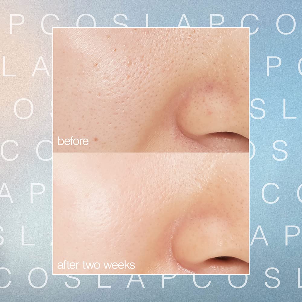 The before and after effects after using the LAPCOS Biome Boost Cream Daily Moisturizer 50ml