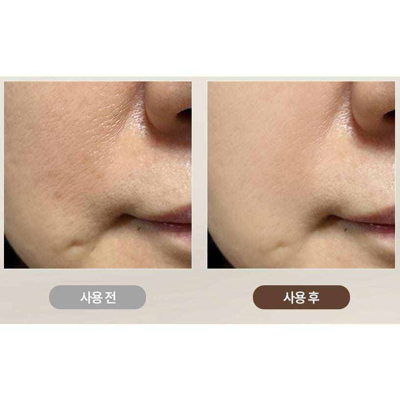 The before and after of the Milk Touch Wild Ginseng Gold PDRN Daily Special Mask 330g*30ea.