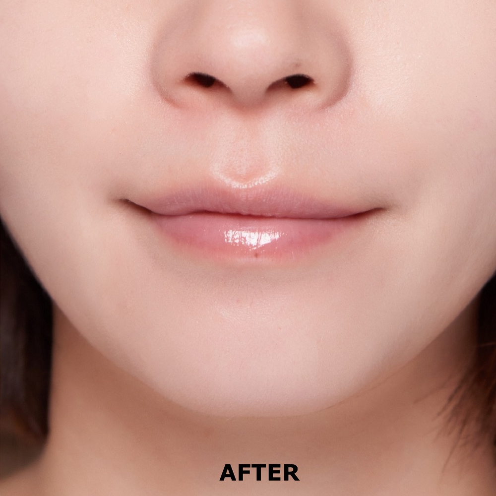 Bonamedusa Lip Wave Delete 15G / Anti Wrinkleボリュームリップトリートメント