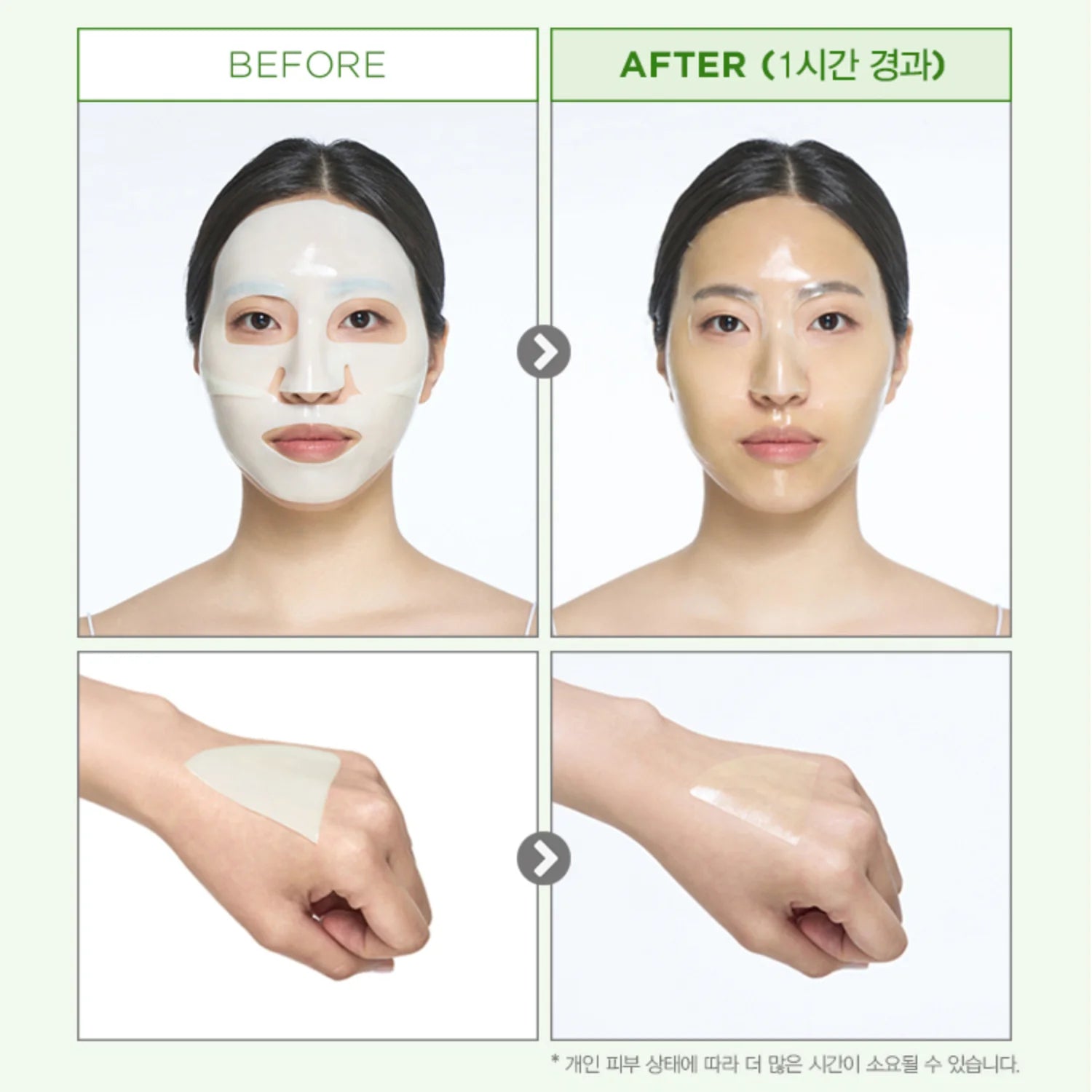 Before and after applying the onoma Redness Reliever Tea Tree Calming Gel Mask Set (4+1)