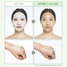 Before and after applying the onoma Redness Reliever Tea Tree Calming Gel Mask Set (4+1)